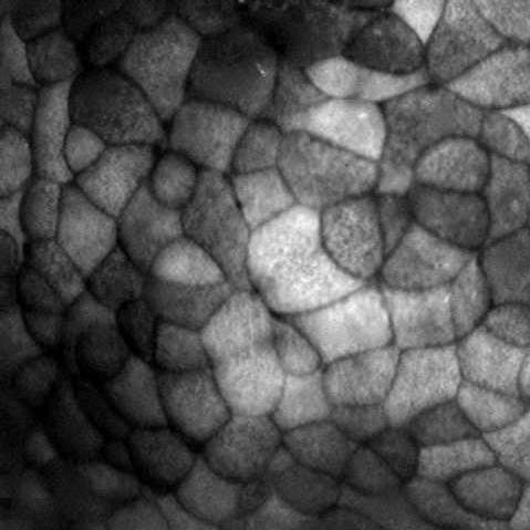 tissue